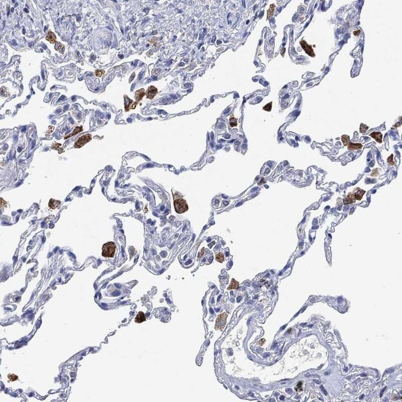 Staining of human lung shows cytoplasmic positivity in macrophages.