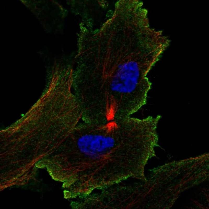 Staining of human cell line ASC52telo shows localization to plasma membrane.