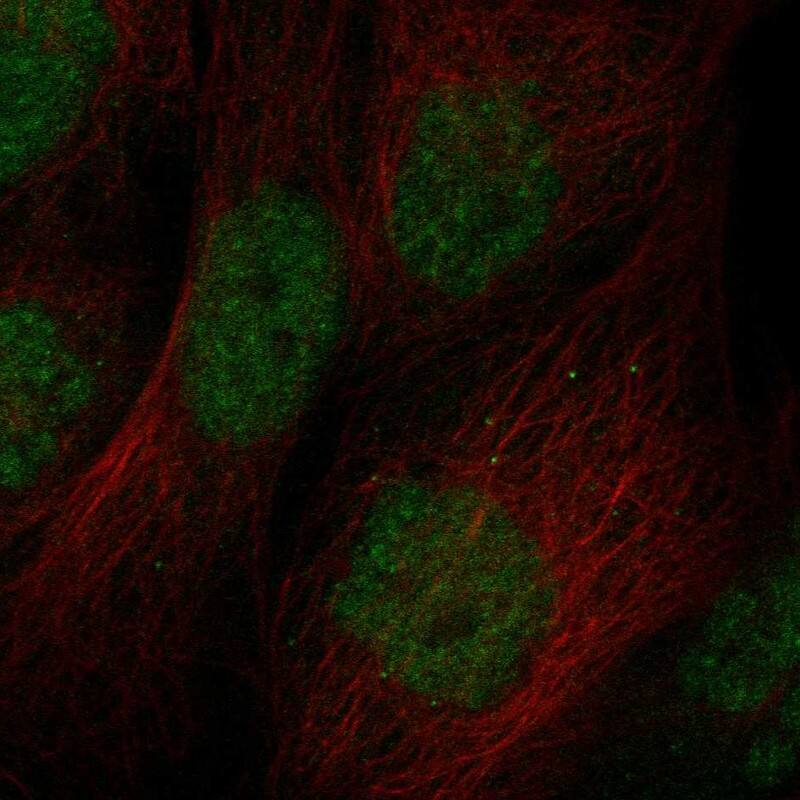 Staining of human cell line EFO-21 shows localization to nucleoplasm.
