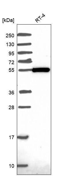 Analysis in human cell line RT-4.