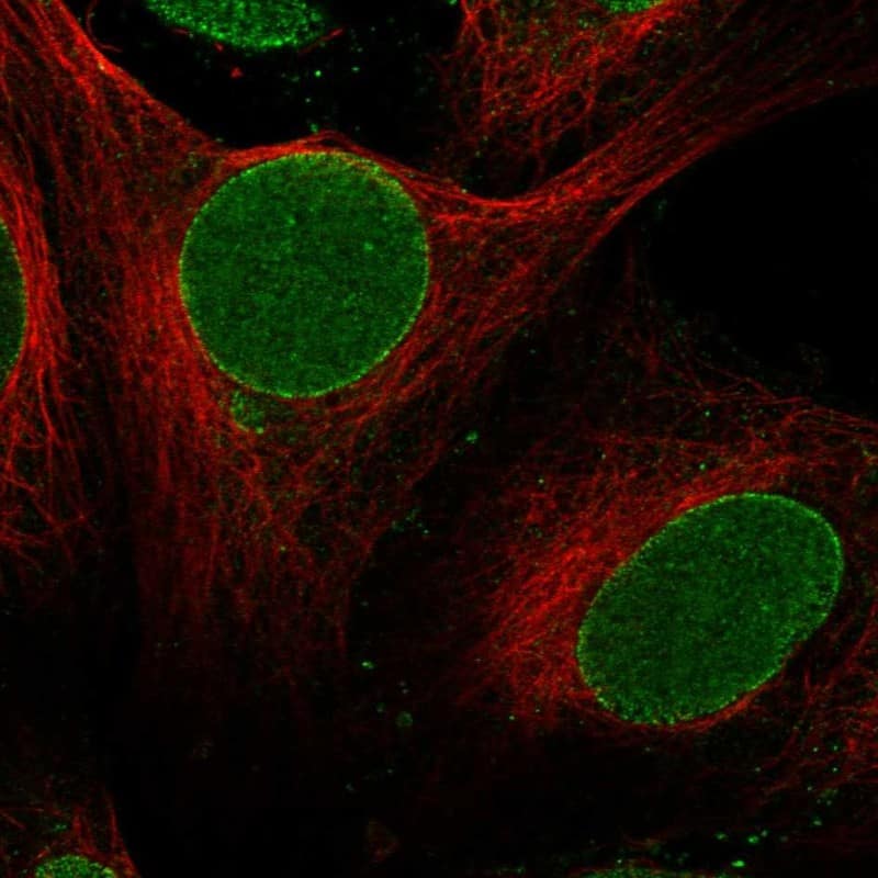 Staining of human cell line U2OS shows localization to nucleoplasm & nuclear membrane.