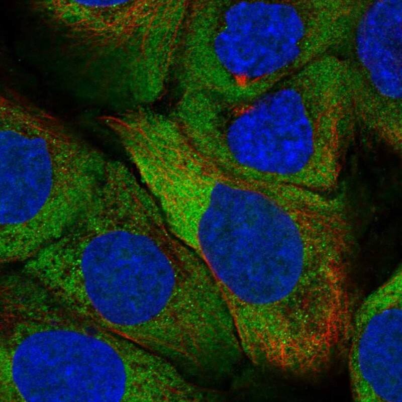 Immunocytochemistry/ Immunofluorescence ZNF385 Antibody - BSA Free