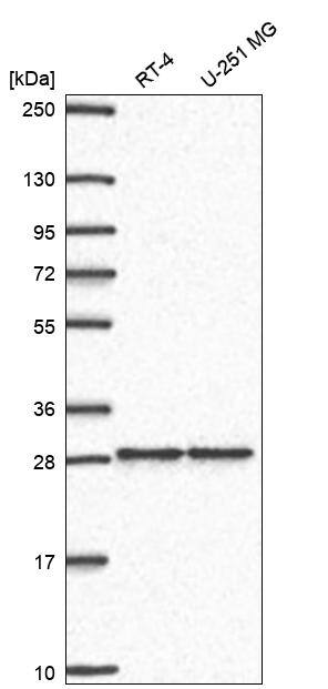Western Blot ZNF385 Antibody - BSA Free