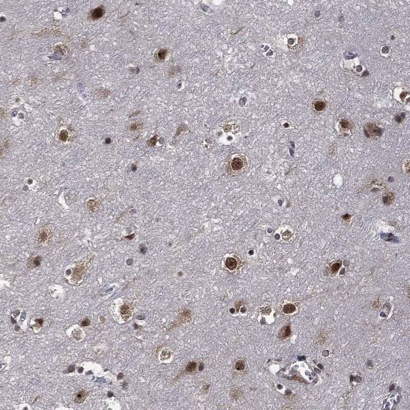 Staining of human cerebral cortex shows strong nuclear positivity in neuronal and glial cells.