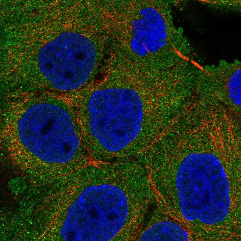 Staining of human cell line A-431 shows localization to plasma membrane.