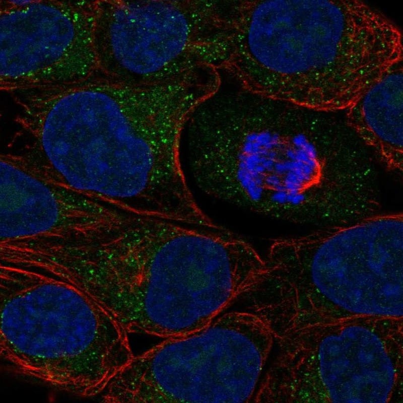Staining of human cell line RT-4 shows localization to vesicles.