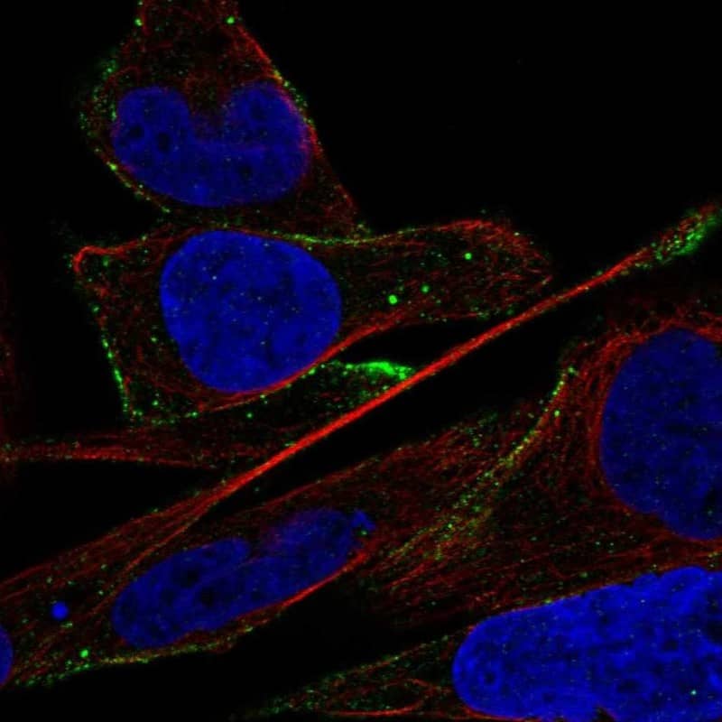 Staining of human cell line Rh30 shows localization to vesicles.