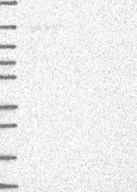 Lane 1: Marker [kDa] 250,130,95,72,55,36,28,17,10Lane 2: RT-4Lane 3: U-251MGLane 4: Human PlasmaLane 5: LiverLane 6: Tonsil