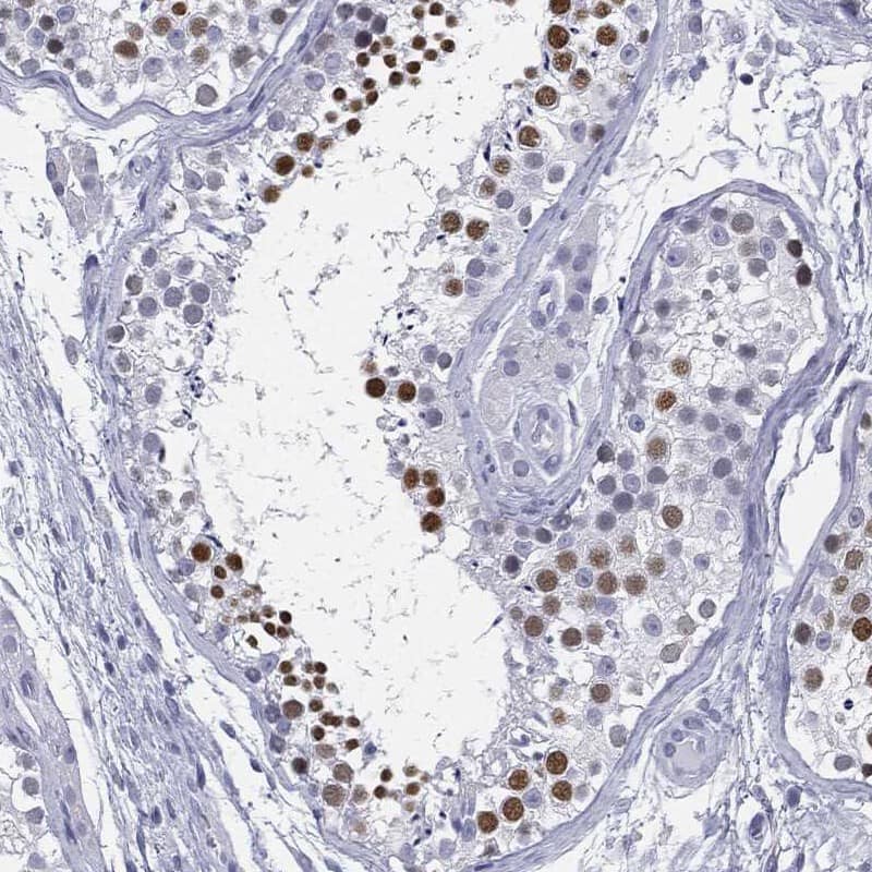 Staining of human testis shows strong nuclear positivity in cells in seminiferous ducts.