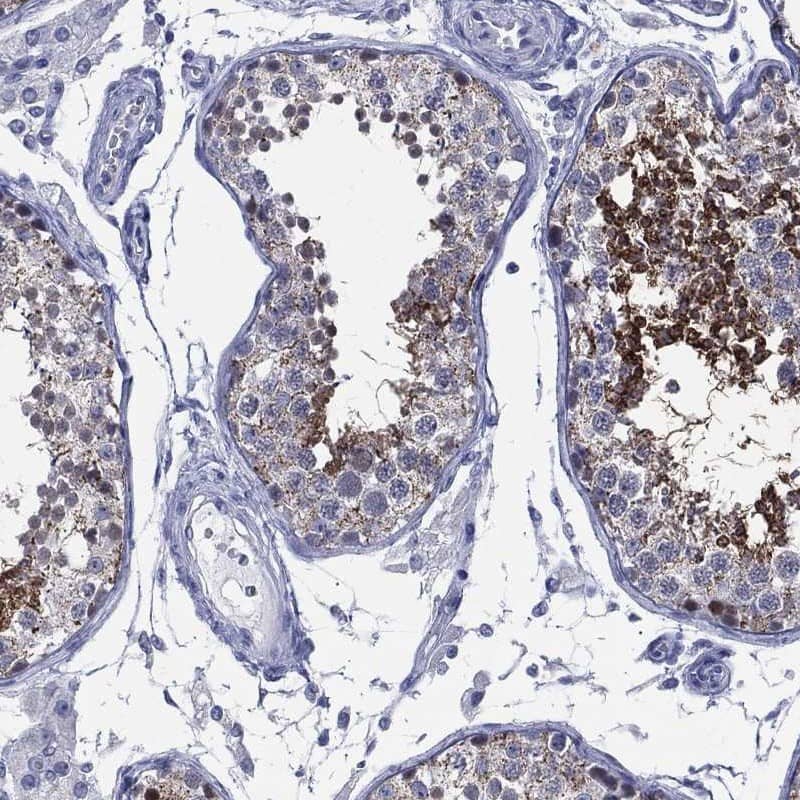 Staining of human testis shows strong cytoplasmic positivity in cells in seminiferous ducts.