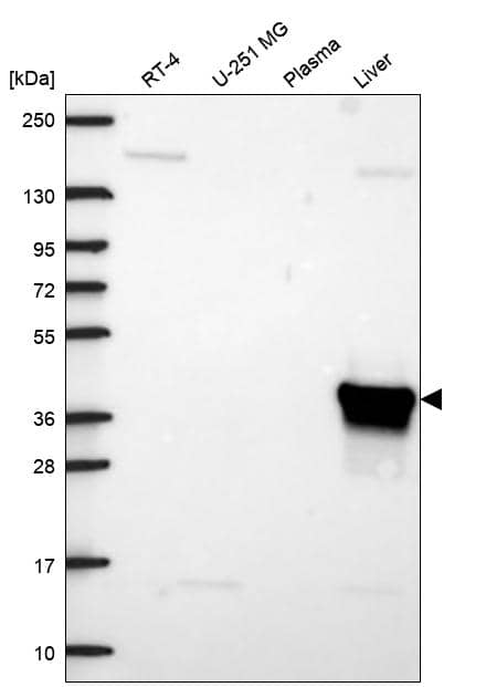Analysis in human cell line RT-4, human cell line U-251 MG, human plasma and human liver tissue.