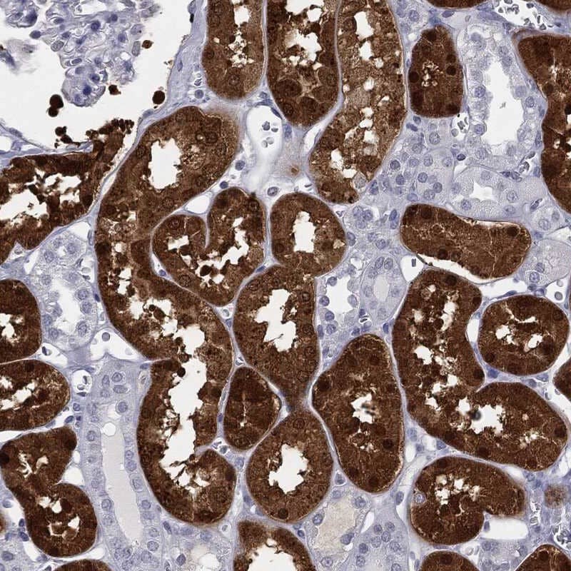 Staining of human kidney shows strong cytoplasmic and nuclear positivity in cells in tubules.