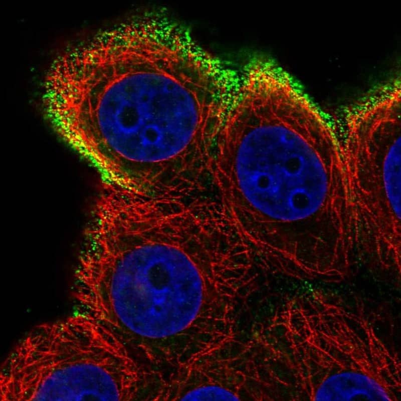 Staining of human cell line MCF-7 shows localization to vesicles.