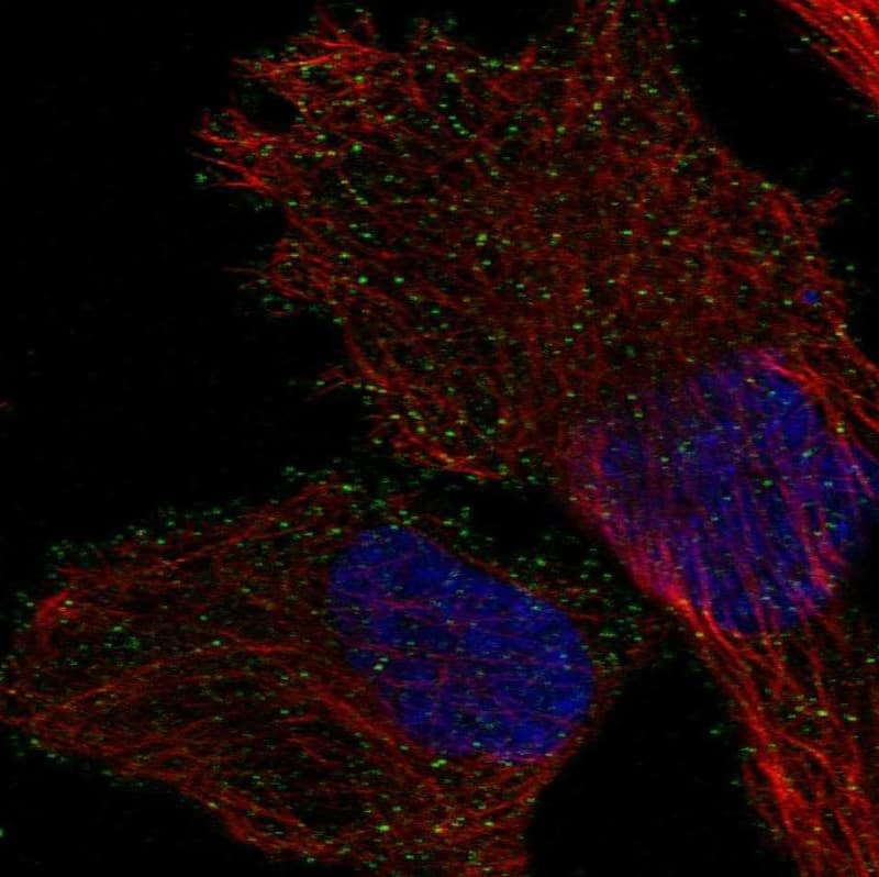 Staining of human cell line PC-3 shows localization to vesicles.