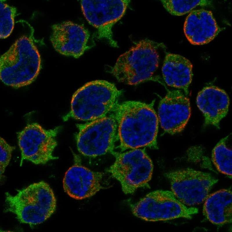 Staining of human cell line JURKAT shows localization to plasma membrane & cytosol.