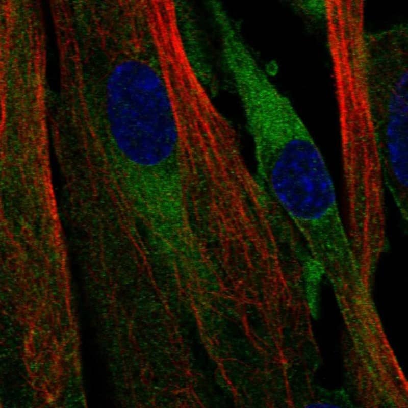 Immunocytochemistry/ Immunofluorescence ATP8B2 Antibody