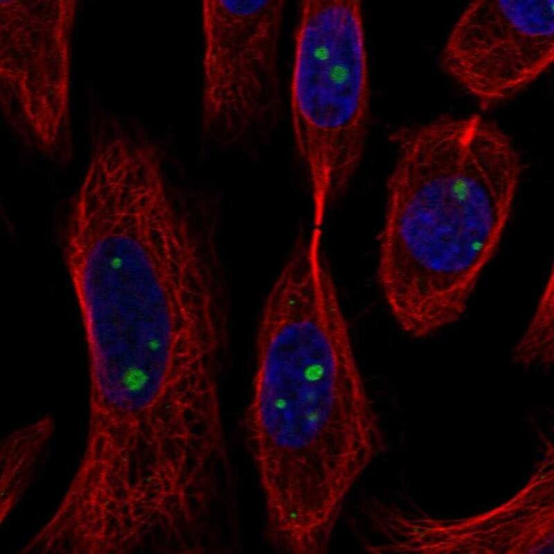 Staining of human cell line SiHa shows localization to nucleoli.