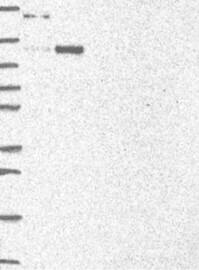 Lane 1: Marker [kDa] 250,130,95,72,55,36,28,17,10Lane 2: RT-4Lane 3: U-251MGLane 4: Human PlasmaLane 5: LiverLane 6: Tonsil