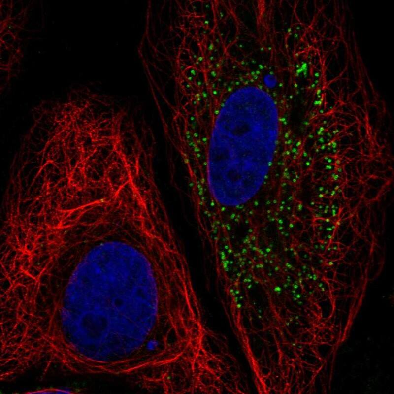 Staining of human cell line GAMG shows localization to vesicles.