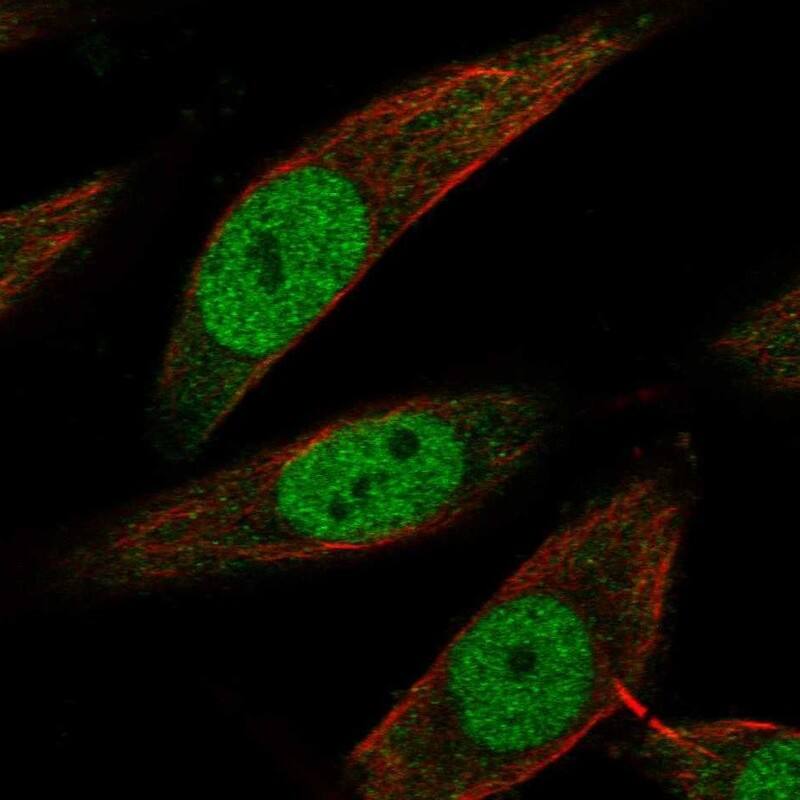 Staining of human cell line SiHa shows localization to nucleoplasm.