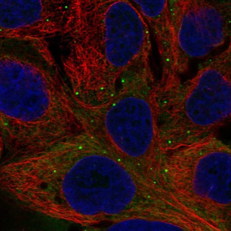 Staining of human cell line CACO-2 shows localization to cytosol & vesicles.