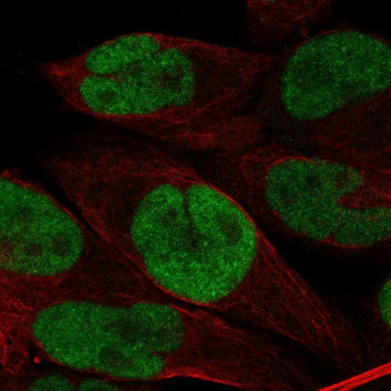 Staining of human cell line Rh30 shows localization to nucleoplasm.