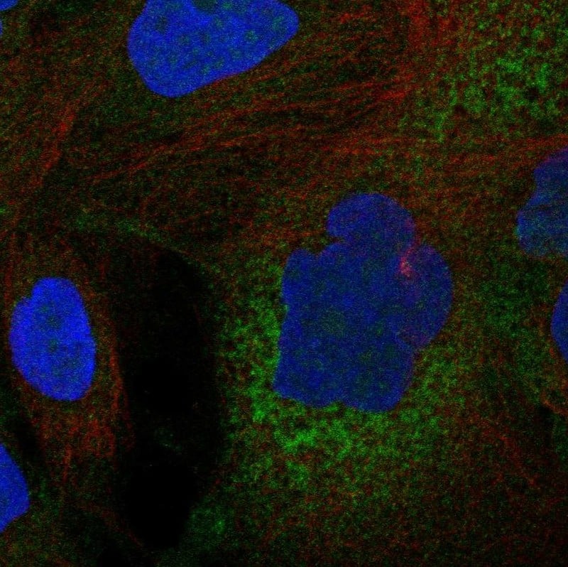 Staining of human cell line EFO-21 shows localization to endoplasmic reticulum.