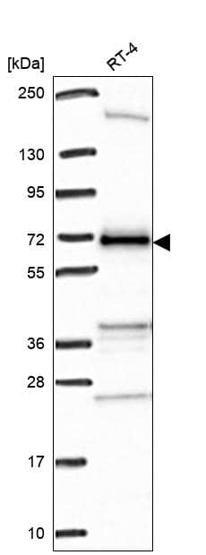 Analysis in human cell line RT-4.