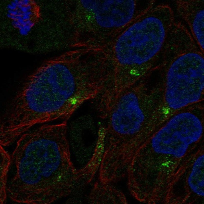 Staining of human cell line RT-4 shows localization to centriolar satellites.