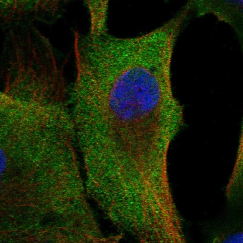 Staining of human cell line GAMG shows localization to plasma membrane.