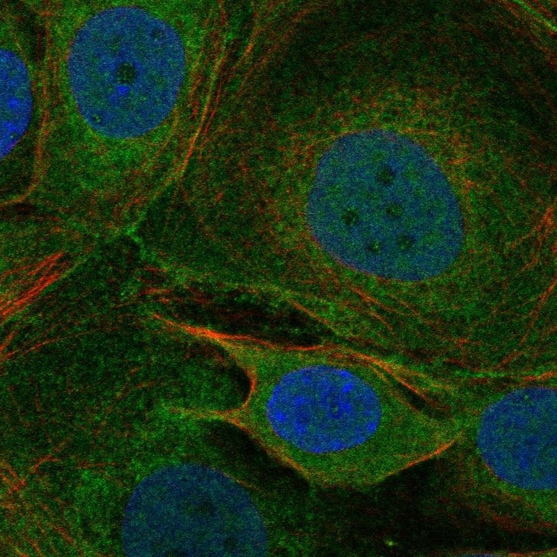 Staining of human cell line MCF-7 shows localization to plasma membrane & cell junctions.