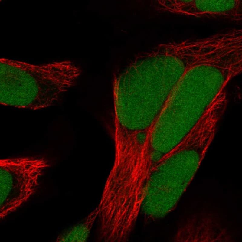 Staining of human cell line Rh30 shows localization to nucleoplasm.
