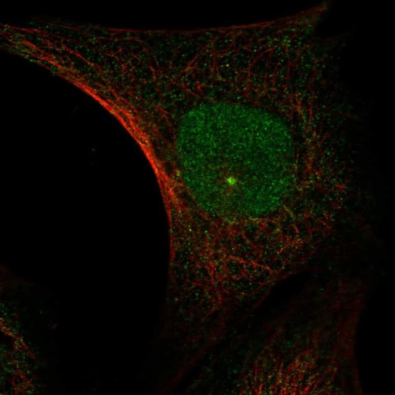 Immunocytochemistry/ Immunofluorescence Jade-1/PHF17 Antibody - BSA Free