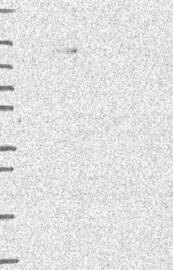 Lane 1: Marker [kDa] 250,130,95,72,55,36,28,17,10Lane 2: RT-4Lane 3: U-251MGLane 4: Human PlasmaLane 5: LiverLane 6: Tonsil