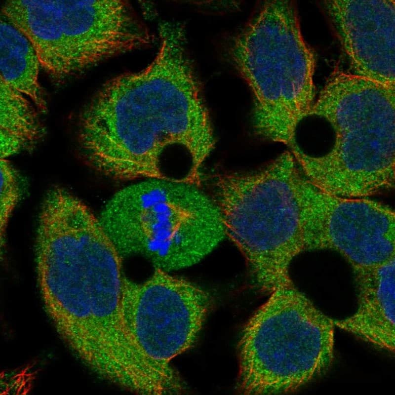 Staining of human cell line OE19 shows localization to cytosol.