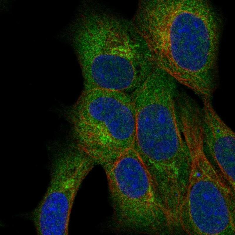 Immunocytochemistry/ Immunofluorescence QTRTD1 Antibody - BSA Free