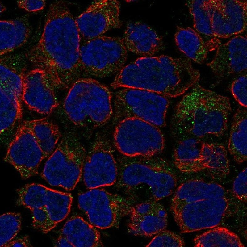 Staining of human cell line JURKAT shows localization to cytosol & vesicles.