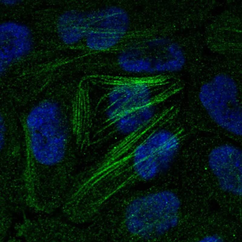 Staining of human cell line RT-4 shows localization to nucleoplasm & actin filaments.