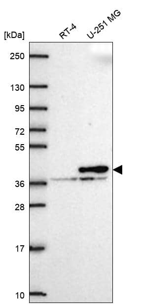 Analysis in human cell line RT-4 and human cell line U-251 MG.
