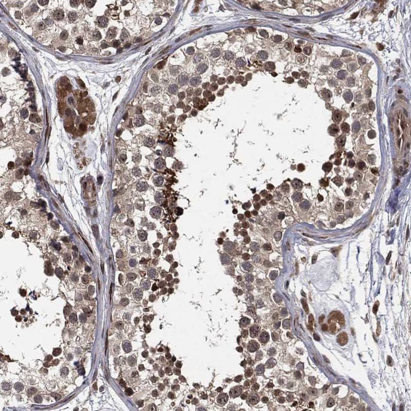 Immunohistochemistry-Paraffin CAPRIN2 Antibody - BSA Free