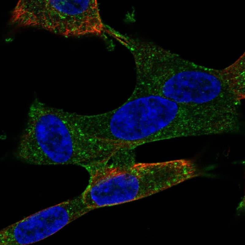 Staining of human cell line SH-SY5Y shows localization to plasma membrane & vesicles.