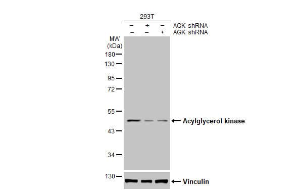 <b>Genetic Strategies Validation. </b>Western Blot: Acylglycerol Kinase Antibody (HL1846) - Azide and BSA Free [NBP3-25352] - Non-transfected (-) and transfected (+) 293T whole cell extract (30 ug) were separated by 10% SDS-PAGE, and the membrane was blotted with Acylglycerol kinase antibody [HL1846] (NBP3-25352) diluted at 1:1000. The HRP-conjugated anti-rabbit IgG antibody was used to detect the primary antibody.