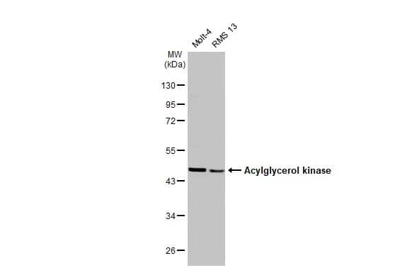 Western Blot: Acylglycerol Kinase Antibody (HL1846) - Azide and BSA Free [NBP3-25352] - Various whole cell extracts (30 ug) were separated by 10% SDS-PAGE, and the membrane was blotted with Acylglycerol kinase antibody [HL1846] (NBP3-25352) diluted at 1:1000. The HRP-conjugated anti-rabbit IgG antibody was used to detect the primary antibody.