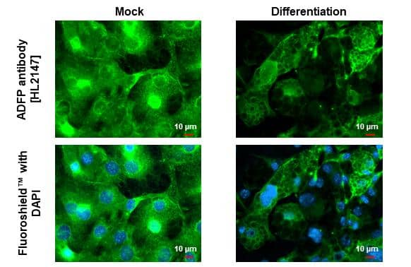 ADFP antibody [HL2147] detects ADFP protein at lipid droplet by immunofluorescent analysis.Sample: Mock and differentiated 3T3-L1 cells were fixed in 4% paraformaldehyde at RT for 15 min.Green: ADFP stained by ADFP antibody [HL2147] (NBP3-25353) diluted at 1:500.Blue: Fluoroshield with DAPI . 