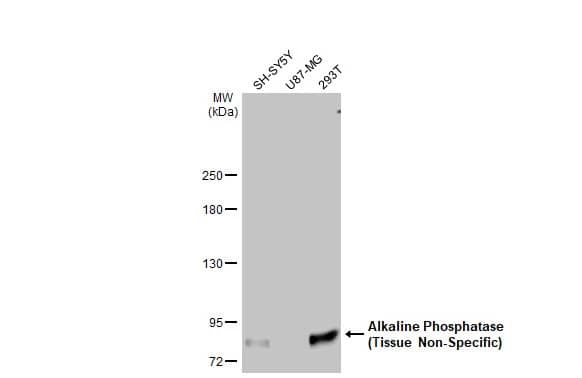 Western Blot: Alkaline Phosphatase, Tissue Non-Specific Antibody (HL2003) - Azide and BSA Free [NBP3-25356] - Various whole cell extracts (30 ug) were separated by 5% SDS-PAGE, and the membrane was blotted with Alkaline Phosphatase (Tissue Non-Specific) antibody [HL2003] (NBP3-25356) diluted at 1:500. The HRP-conjugated anti-rabbit IgG antibody was used to detect the primary antibody, and the signal was developed with Trident ECL plus-Enhanced.