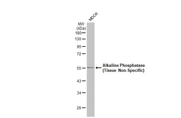 Western Blot: Alkaline Phosphatase, Tissue Non-Specific Antibody (HL2003) - Azide and BSA Free [NBP3-25356] - Whole cell extract (30 ug) was separated by 10% SDS-PAGE, and the membrane was blotted with Alkaline Phosphatase (Tissue Non-Specific) antibody [HL2003] (NBP3-25356) diluted at 1:1000. The HRP-conjugated anti-rabbit IgG antibody was used to detect the primary antibody, and the signal was developed with Trident ECL plus-Enhanced.