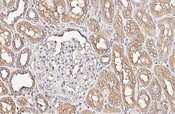 Alkaline Phosphatase (Tissue Non-Specific) antibody [HL2003] detects Alkaline Phosphatase (Tissue Non-Specific) protein by immunohistochemical analysis.Sample: Paraffin-embedded human kidney.Alkaline Phosphatase (Tissue Non-Specific) stained by Alkaline Phosphatase (Tissue Non-Specific) antibody [HL2003] (NBP3-25356) diluted at 1:500.Antigen Retrieval: Citrate buffer, pH 6.0, 15 min 