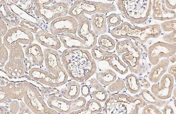 Alkaline Phosphatase (Tissue Non-Specific) antibody [HL2003] detects Alkaline Phosphatase (Tissue Non-Specific) protein by immunohistochemical analysis.Sample: Paraffin-embedded mouse kidney.Alkaline Phosphatase (Tissue Non-Specific) stained by Alkaline Phosphatase (Tissue Non-Specific) antibody [HL2003] (NBP3-25356) diluted at 1:500.Antigen Retrieval: Citrate buffer, pH 6.0, 15 min 
