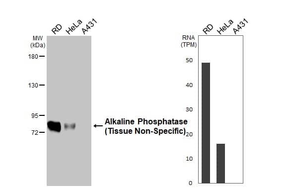 Various whole cell extracts (30 ug) were separated by 5% SDS-PAGE, and the membrane was blotted with Alkaline Phosphatase (Tissue Non-Specific) antibody [HL2003] (NBP3-25356) diluted at 1:500. The HRP-conjugated anti-rabbit IgG antibody  was used to detect the primary antibody. Corresponding RNA expression data for the same cell lines are based on Human Protein Atlas program. 