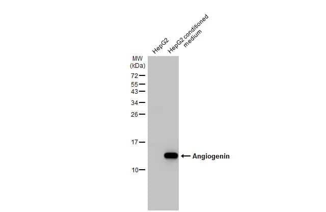 Western Blot: Angiogenin Antibody (HL2214) - Azide and BSA Free [NBP3-25360] - HepG2 whole cell extract and conditioned medium (30 ug) were separated by 15% SDS-PAGE, and the membrane was blotted with Angiogenin antibody [HL2214] (NBP3-25360) diluted at 1:1000. The HRP-conjugated anti-rabbit IgG antibody was used to detect the primary antibody.